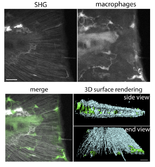 Microscopy image of collagen fibers and macrophages in zebrafish